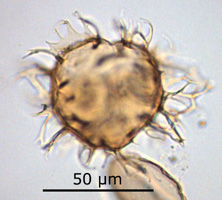 Areoligera senonensis