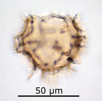 Areoligera senonensis