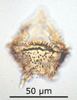 Spinidinium densispinatum